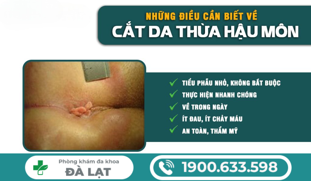 Hình ảnh minh họa
